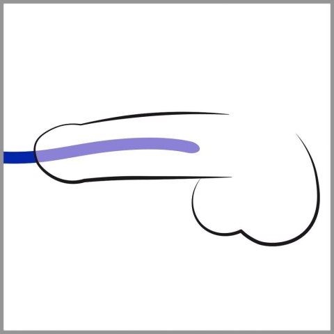 Silicone Dilator Set Silicone Dilator Set